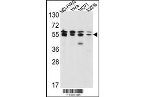 Western blot analysis of IMPDH2 Antibody in NCI-H460,Hela,MCF7,A2058 cell line lysates(35ug/lane) (IMPDH2 Antikörper  (AA 180-210))