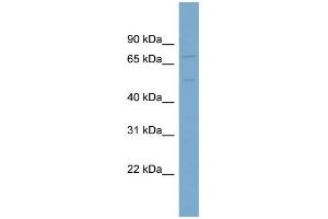 WB Suggested Anti-SLC7A1 Antibody Titration:  0. (SLC7A1 Antikörper  (N-Term))