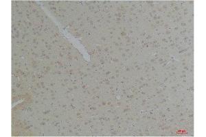 Immunohistochemistry (IHC) analysis of paraffin-embedded Rat Brain Tissue using KCNK10 (TREK-2) Rabbit Polyclonal Antibody diluted at 1:200. (KCNK10 Antikörper)