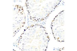 Immunohistochemistry of paraffin-embedded mouse testis using DDX50 antibody (ABIN6129371, ABIN6139509, ABIN6139510 and ABIN6224730) at dilution of 1:100 (40x lens). (DDX50 Antikörper  (AA 1-135))
