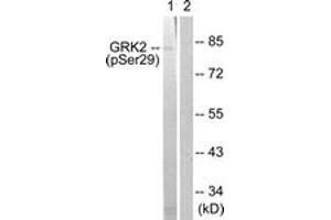 Western blot analysis of extracts from Jurkat cells treated with EGF 200ng/ml 30', using GRK2 (Phospho-Ser29) Antibody. (GRK2 Antikörper  (pSer29))