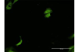 Immunofluorescence of monoclonal antibody to PRKDC on HeLa cell. (PRKDC Antikörper  (AA 4019-4128))