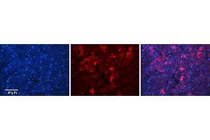 Rabbit Anti-MFN2 Antibody   Formalin Fixed Paraffin Embedded Tissue: Human Heart Tissue Observed Staining: Cytoplasm in cardiomyocytes Primary Antibody Concentration: 1:100 Other Working Concentrations: N/A Secondary Antibody: Donkey anti-Rabbit-Cy3 Secondary Antibody Concentration: 1:200 Magnification: 20X Exposure Time: 0. (MFN2 Antikörper  (C-Term))