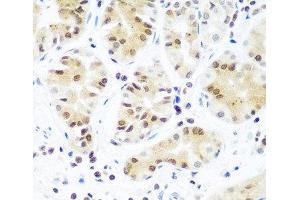 Immunohistochemistry of paraffin-embedded Human stomach using Argonaute-2 Polyclonal Antibody at dilution of 1:100 (40x lens).