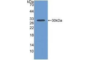 Detection of Recombinant FBLN1, Human using Polyclonal Antibody to Fibulin 1 (FBLN1) (Fibulin 1 Antikörper  (AA 176-398))