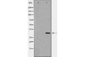 Western blot analysis of Bag 1 expression in HeLa cell lysate,The lane on the left is treated with the antigen-specific peptide. (BAG1 Antikörper  (N-Term))