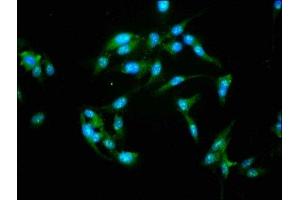 Immunofluorescence staining of Hela cells with ABIN7161797 at 1:155, counter-stained with DAPI. (NFATC3 Antikörper  (AA 887-1070))
