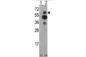 Image no. 1 for anti-tyrosine Kinase, Non-Receptor, 2 (TNK2) (N-Term) antibody (ABIN452711) (TNK2 Antikörper  (N-Term))
