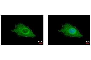 ICC/IF Image FIG4 antibody detects FIG4 protein at cytoplasm by immunofluorescent analysis. (FIG4 Antikörper  (Center))