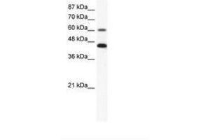 Image no. 1 for anti-Annexin A6 (ANXA6) (AA 28-77) antibody (ABIN203241) (ANXA6 Antikörper  (AA 28-77))