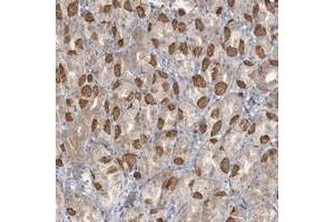 Immunohistochemical staining of human stomach with TBC1D5 polyclonal antibody  shows moderate cytoplasmic positivity in parietal cells. (TBC1D5 Antikörper)