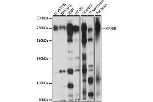 Western blot analysis of extracts of various cell lines, using KIF20B antibody. (KIF20B Antikörper)