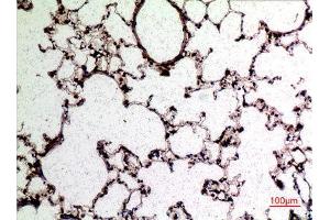 Immunohistochemistry (IHC) analysis of paraffin-embedded Rat Lung, antibody was diluted at 1:100. (L-Selectin Antikörper  (Internal Region))