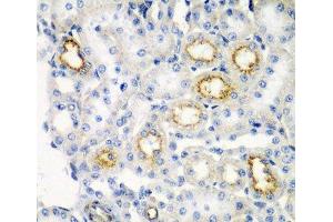 Immunohistochemistry of paraffin-embedded Rat kidney using RARRES2 Polyclonal Antibody at dilution of 1:200 (40x lens). (Chemerin Antikörper)