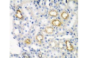 Immunohistochemistry of paraffin-embedded Rat kidney using RARRES2 Polyclonal Antibody at dilution of 1:200 (40x lens).
