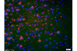 Formalin-fixed and paraffin-embedded rat brain labeled with Anti-NKA/Neurokinin A Polyclonal Antibody, Unconjugated (ABIN724445) 1:200, overnight at 4°C, The secondary antibody was Goat Anti-Rabbit IgG, Cy3 conjugated used at 1:200 dilution for 40 minutes at 37°C. (NKA Antikörper  (AA 98-107))