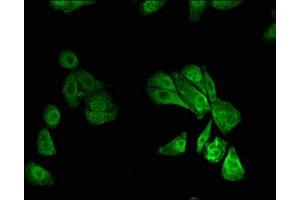 Immunofluorescent analysis of HepG2 cells using ABIN7168481 at dilution of 1:100 and Alexa Fluor 488-congugated AffiniPure Goat Anti-Rabbit IgG(H+L) (RUNX1 Antikörper  (AA 211-445))