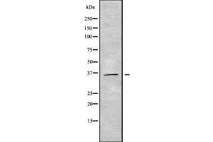 GIMAP7 antibody  (N-Term)