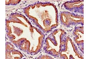 Immunohistochemistry of paraffin-embedded human prostate tissue using ABIN7157208 at dilution of 1:100 (Kallikrein 2 Antikörper  (AA 25-261))