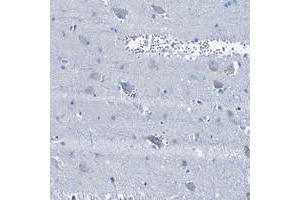 Immunohistochemical staining of human lateral ventricle with BFSP2 polyclonal antibody  shows weak cytoplasmic positivity in neuronal cells. (BFSP2 Antikörper)