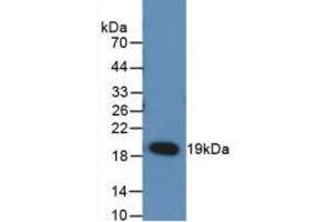 Figure. (RANKL Antikörper  (AA 106-240))