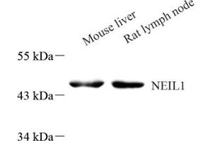 Western blot analysis of Neil1 (ABIN7073820) at dilution of 1: 800 (NEIL1 Antikörper)