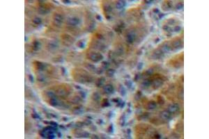 IHC-P analysis of Liver tissue, with DAB staining. (A1BG Antikörper  (AA 22-219))