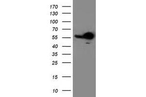 HEK293T cells were transfected with the pCMV6-ENTRY control (Left lane) or pCMV6-ENTRY RBBP7 (Right lane) cDNA for 48 hrs and lysed. (RBBP7 Antikörper)