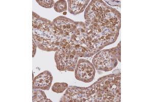 Immunohistochemical analysis of B on paraffin-embedded Human placenta tissue. (WDR41 Antikörper  (C-Term))