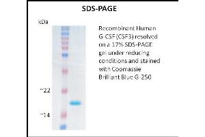 SDS-PAGE (SDS) image for Colony Stimulating Factor 3 (Granulocyte) (CSF3) (Active) protein (ABIN5509310) (G-CSF Protein)