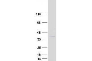 COMM Domain Containing 8 (COMMD8) protein (Myc-DYKDDDDK Tag)