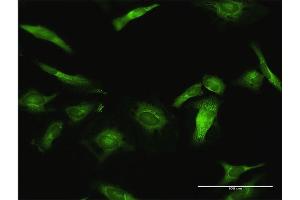 Immunofluorescence of purified MaxPab antibody to USP10 on HeLa cell. (USP10 Antikörper  (AA 1-798))
