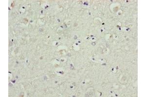 Immunohistochemistry of paraffin-embedded human brain tissue using ABIN7145267 at dilution of 1:100 (BATF2 Antikörper  (AA 1-189))