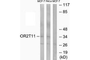 Western blot analysis of extracts from MCF-7/HeLa cells, using OR2T11 Antibody. (OR2T11 Antikörper  (AA 51-100))