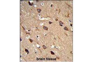 Immunohistochemistry (Paraffin-embedded Sections) (IHC (p)) image for anti-Amiloride-Sensitive Cation Channel 2, Neuronal (ACCN2) (AA 500-526), (C-Term) antibody (ABIN653218)