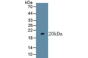 Western Blotting (WB) image for anti-Lymphotoxin beta Receptor (TNFR Superfamily, Member 3) (LTBR) (AA 66-215) antibody (ABIN7427354)