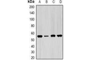 Western blot analysis of IMPDH2 expression in Hela (A), PC3 (B), mouse spleen (C), mouse heart (D) whole cell lysates. (IMPDH2 Antikörper)