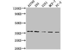 Western Blot Positive WB detected in: A2780 whole cell lysate, 293 whole cell lysate, U251 whole cell lysate, MCF-7 whole cell lysate, PC-3 whole cell lysate All lanes: PDCL3 antibody at 1:2000 Secondary Goat polyclonal to rabbit IgG at 1/50000 dilution Predicted band size: 28 kDa Observed band size: 37 kDa (PDCL3 Antikörper  (AA 1-239))