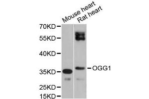 Western blot analysis of extracts of various cell lines, using OGG1 antibody (ABIN1873998) at 1:1000 dilution. (OGG1 Antikörper)