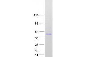 Validation with Western Blot