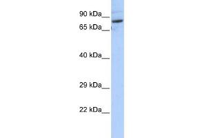 WB Suggested Anti-SPTLC2 Antibody Titration:  0. (SPTLC2 Antikörper  (N-Term))