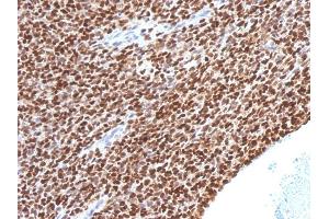 Immunohistochemistry (IHC) image for anti-NK2 Homeobox 2 (Nkx2-2) (AA 1-119) antibody (ABIN6940202)