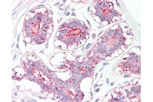 Anti-MAGEA1 / MAGE 1 antibody IHC of human breast. (MAGEA1 Antikörper  (AA 38-87))