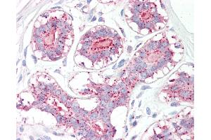 Anti-MAGEA1 / MAGE 1 antibody IHC of human breast. (MAGEA1 Antikörper  (AA 38-87))
