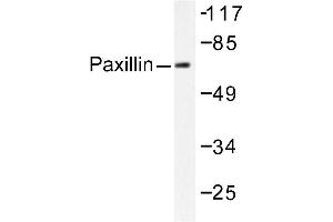 Image no. 2 for anti-Paxillin (PXN) antibody (ABIN271779) (Paxillin Antikörper)