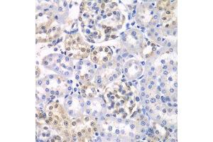 Immunohistochemistry of paraffin-embedded rat kidney using HDAC2 antibody. (HDAC2 Antikörper  (C-Term))