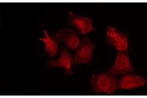 ABIN6277264 staining NIH-3T3 by IF/ICC. (MMP14 Antikörper  (C-Term))