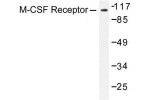 Image no. 1 for anti-Colony Stimulating Factor 1 Receptor (CSF1R) antibody (ABIN272017) (CSF1R Antikörper)