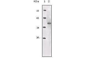 Western blot analysis using IGF1R-Beta mouse mAb against truncated IGF1R recombinant protein.
