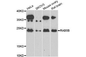Western blot analysis of extracts of various cell lines, using RAB5B antibody. (RAB5B Antikörper)
